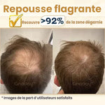 Shampoing repousse instantanée au gingembre Ginaday™