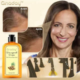 Shampoing repousse instantanée au gingembre Ginaday™